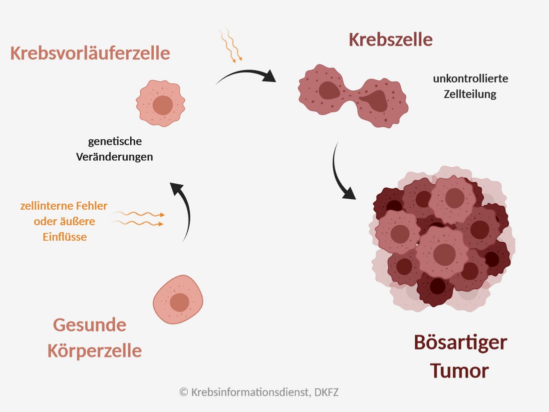 Darstellung wie aus einer gesunden Körperzelle ein bösartiger Tumor entstehen kann