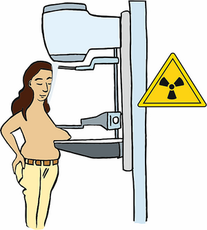 Frau bei einer Mammografie-Untersuchung.