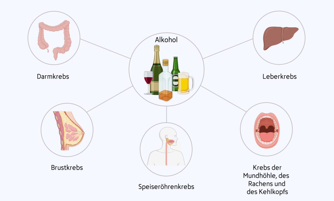 Darstellung mit den verschiedenen Tumorarten, für die Alkohol als Risikofaktor gilt.