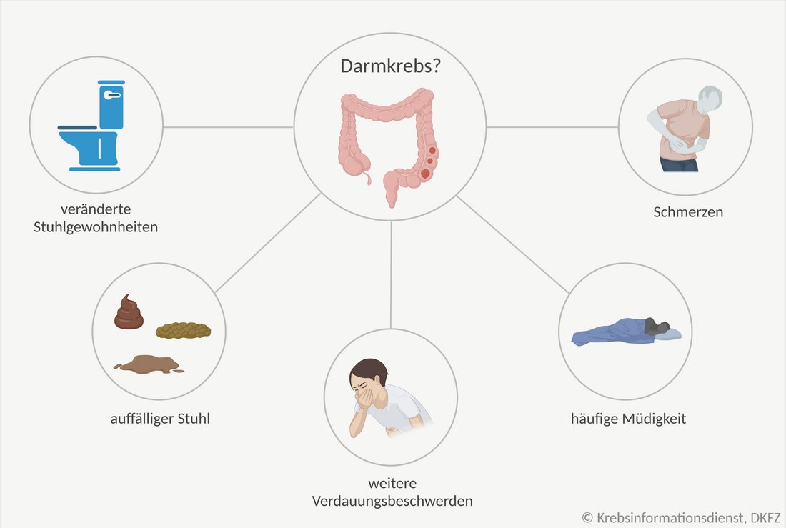 Darstellung mit möglichen Symptomen von Darmkrebs