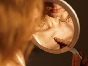 Frau vor Handspiegel mit Finger auf ein Muttermal gerichtet