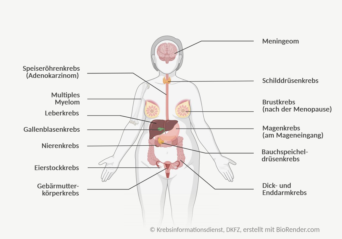 Menschliche Silhouette mit Beschriftungen der 13 Krebsarten mit erhöhtem Risiko durch Adipositas