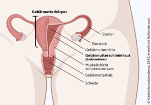 Schematische Darstellung des Gebärmutterkörpers